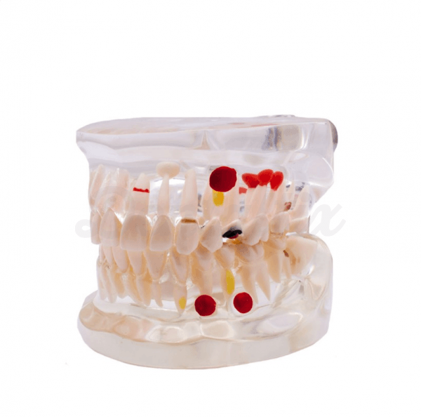 DIDACTICO CARIES