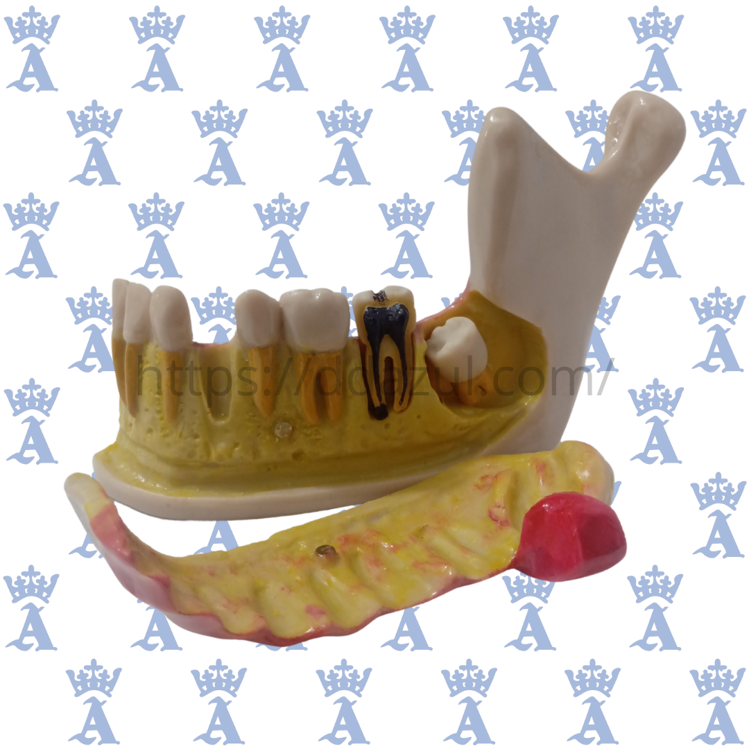MANDIBULAC/NERVIO DENTARIO SANDO